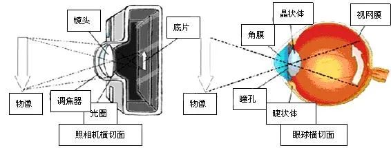 老年人都会得的白内障，到底该什么时候治？插图